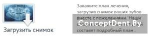zagruzit_snimok2